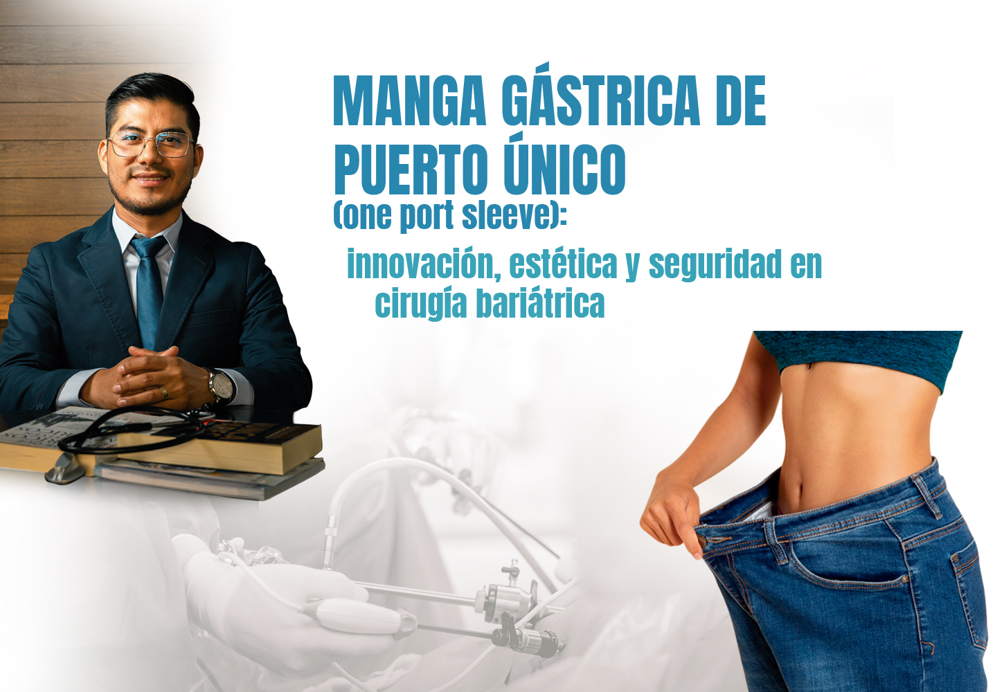 MANGA GÁSTRICA DE PUERTO ÚNICO (One Port Sleeve): Innovación, Estética y Seguridad en Cirugía Bariátrica
